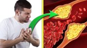Vliv cholesterolu na cévy a srdce: ucpaná tepna a bolest na hrudi.